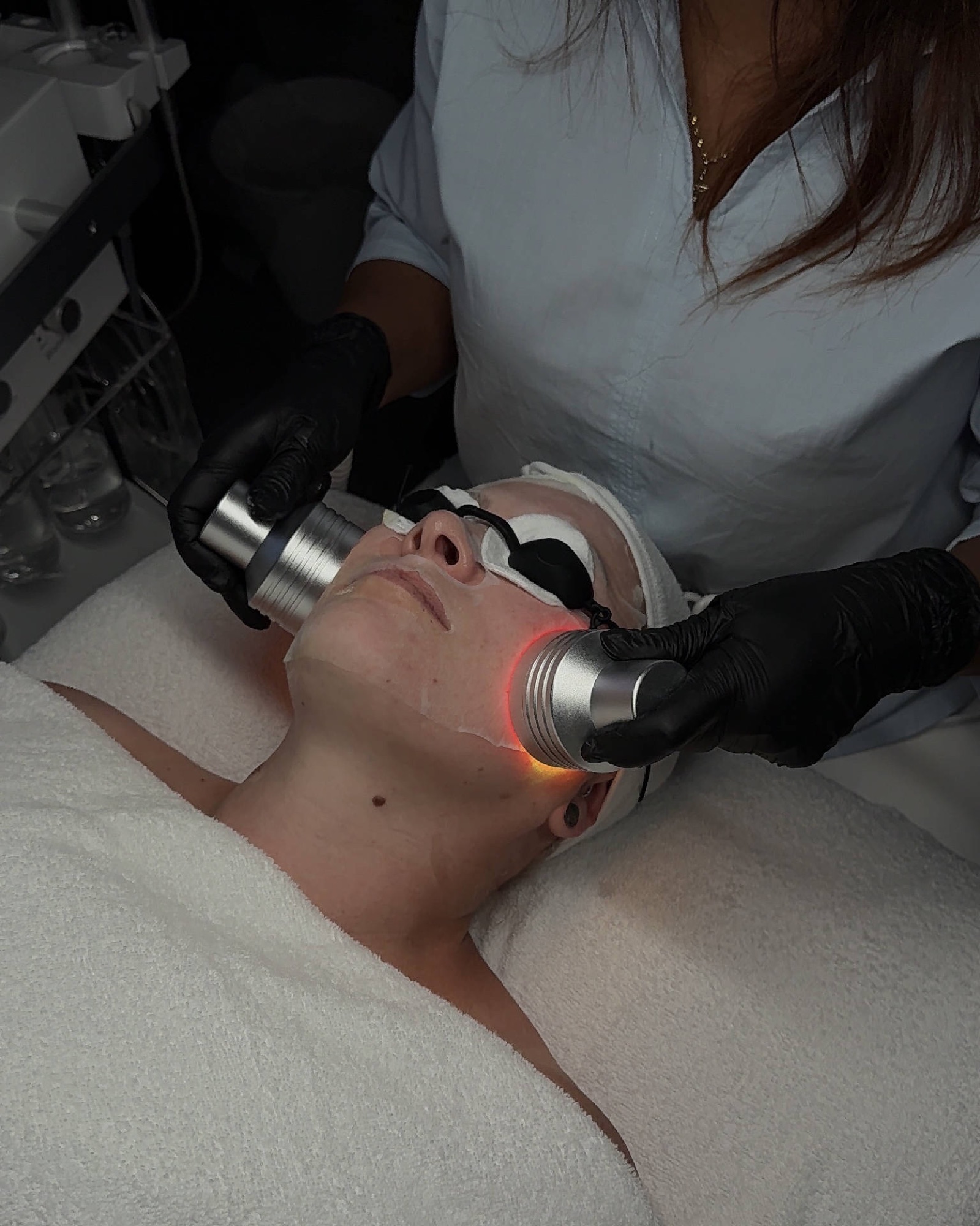 Microneedling in Alzey – Schönheitsblick Alzey